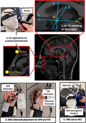 How accurate are coordinate systems being used for transcranial magnetic stimulation?